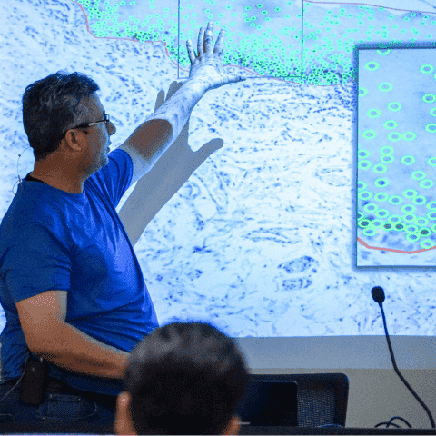 Doctoral Meeting: 'Detección de células en imágenes inmunohistoquímicas biomédicas'